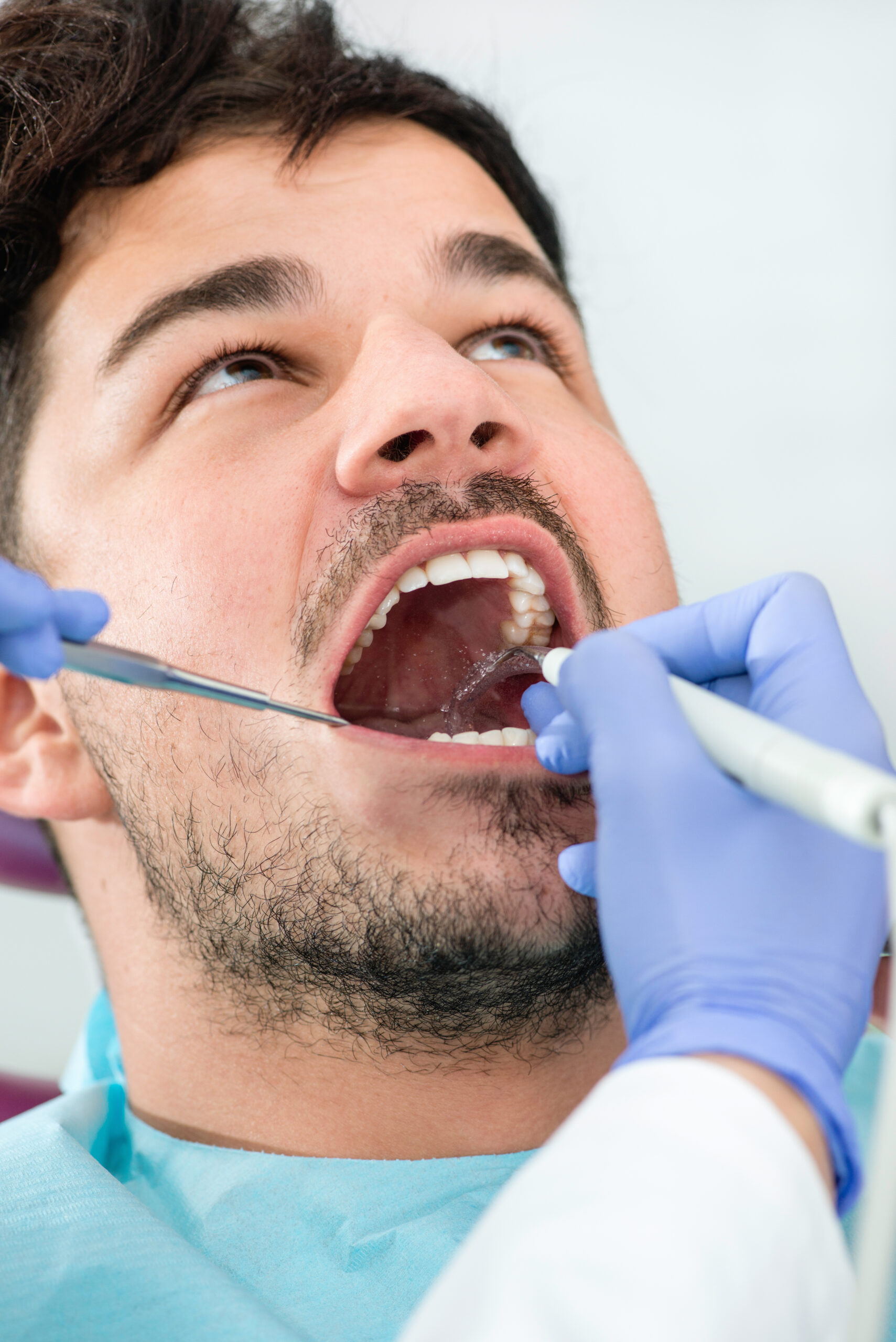 Dentist cleaning dental plaque
