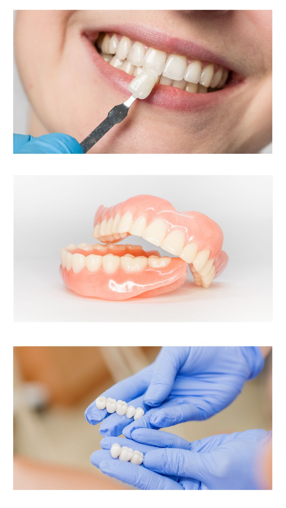 Dental Cosmetics