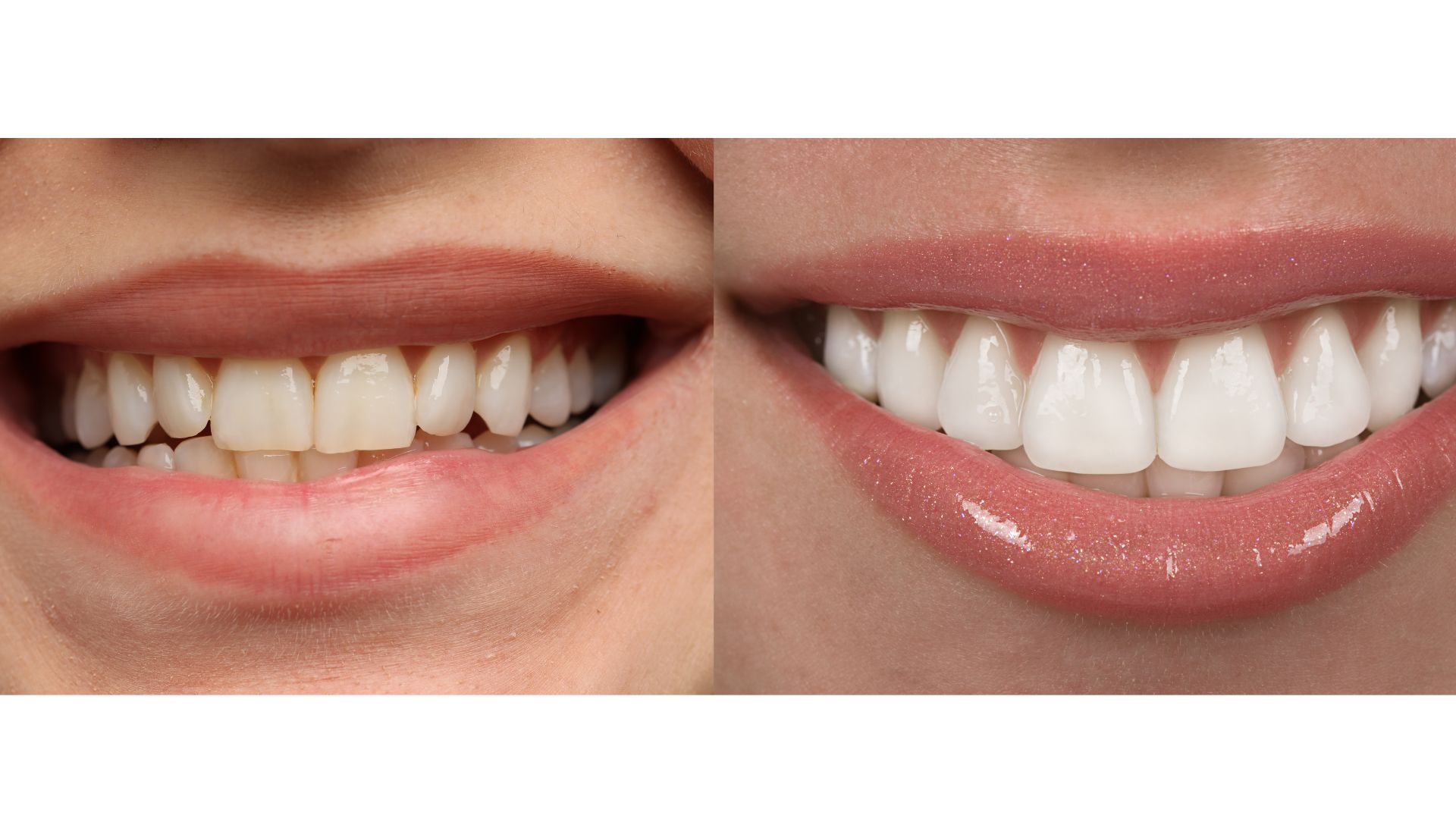 HEALTHY TOOTH